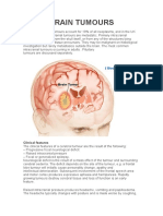 Brain Tumours: Clinical Features