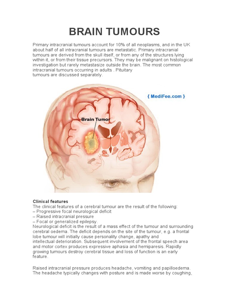 Brain Tumours: Clinical Features | PDF | Brain Tumor | Neurology