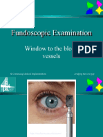 Fundoscopic_Examination