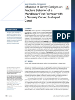 In Uence of Cavity Designs On Fracture Behavior of A Mandibular First Premolar With A Severely Curved H-Shaped Canal