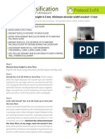 Osseodensification: Protocol 3 of 6