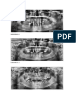 Interpretacion Radiografica