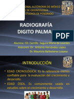 RX Digito Palmar