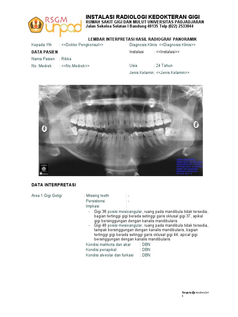 Interpretasi Radiografi Panoramik Gigi | PDF