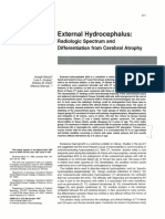 External Hydrocephalus:: Radiologic Spectrum and Differentiation From Cerebral Atrophy