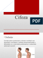 cifoza