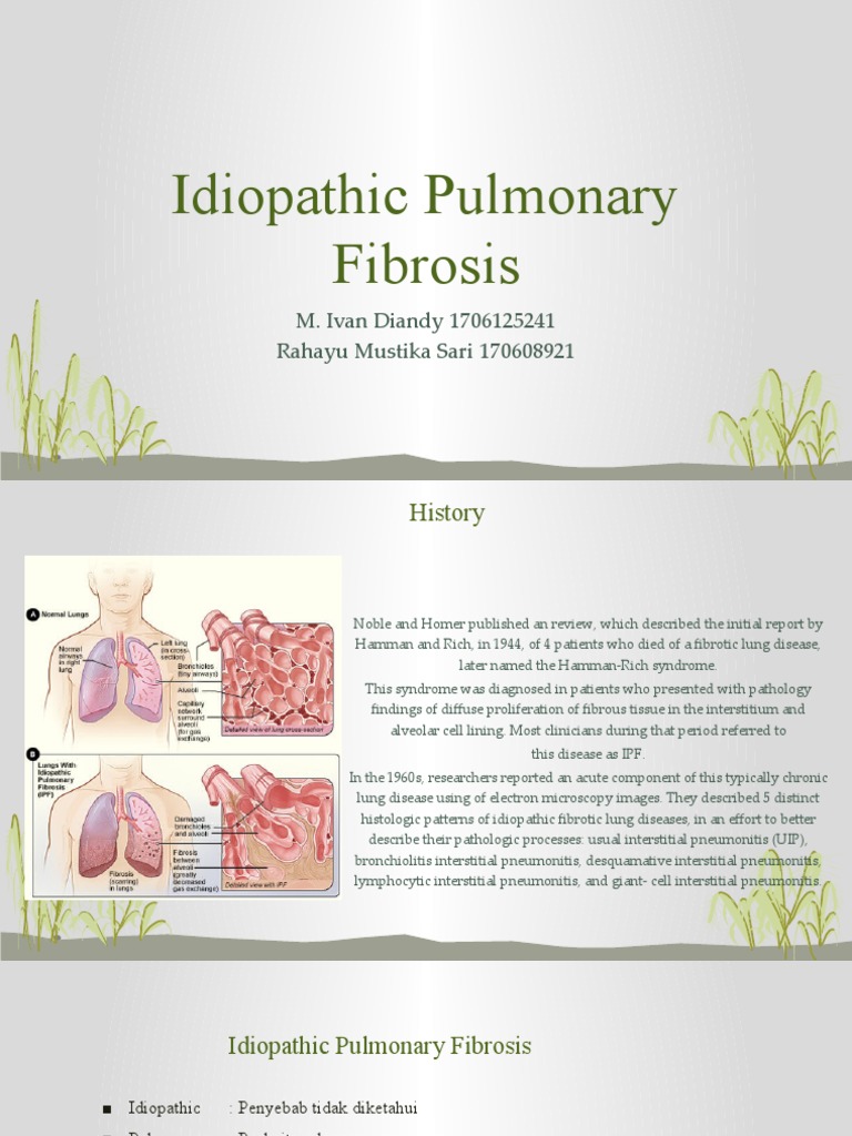 Understanding Idiopathic Pulmonary Fibrosis | PDF | Clinical Medicine ...