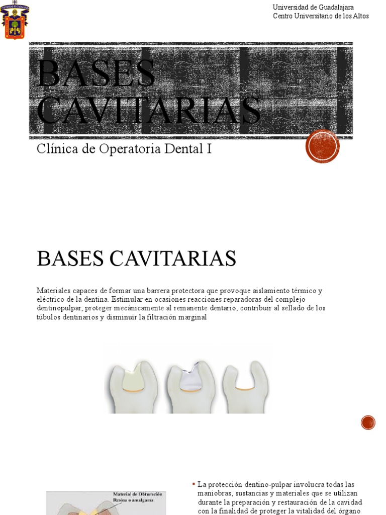 Bases Cavitarias | PDF | Dentina | Calcio