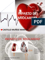 Infarto Miocardio 2021
