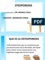 OSTEOPOROSIS