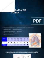 Radiografía de Tórax