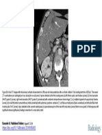 10 1148-Radiol 2018180492figure3