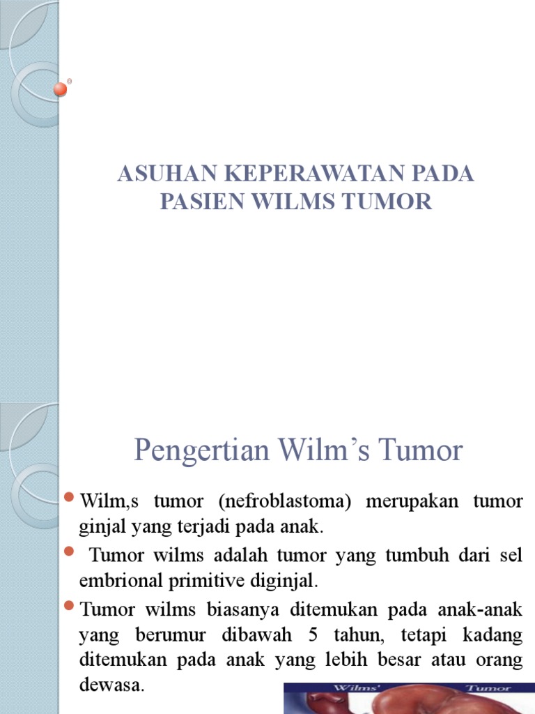 Wilms Tumor | PDF