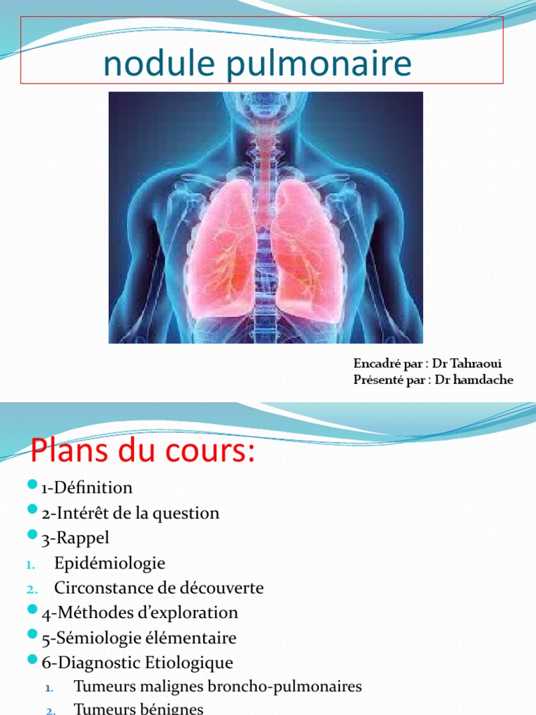 Nodule Pulmonaire Signes Les Différentes Nodules Pulmonaires OZIAA — free download