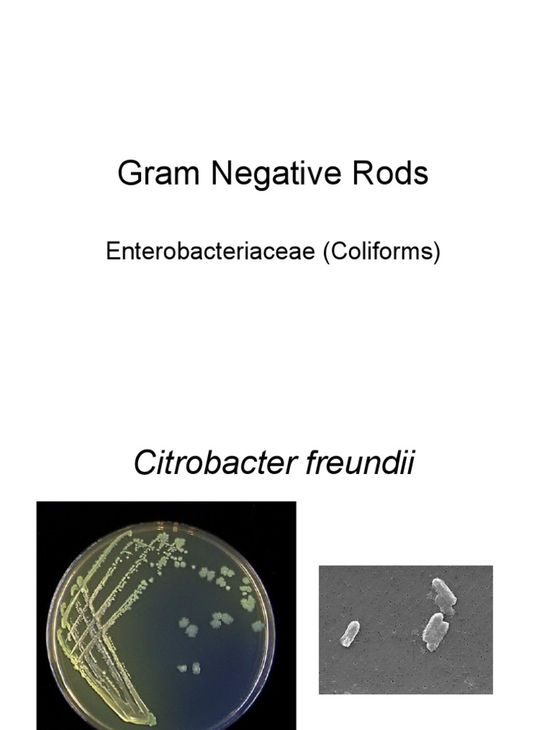 Gram Negative Rods: Enterobacteriaceae (Coliforms) | PDF | Escherichia ...