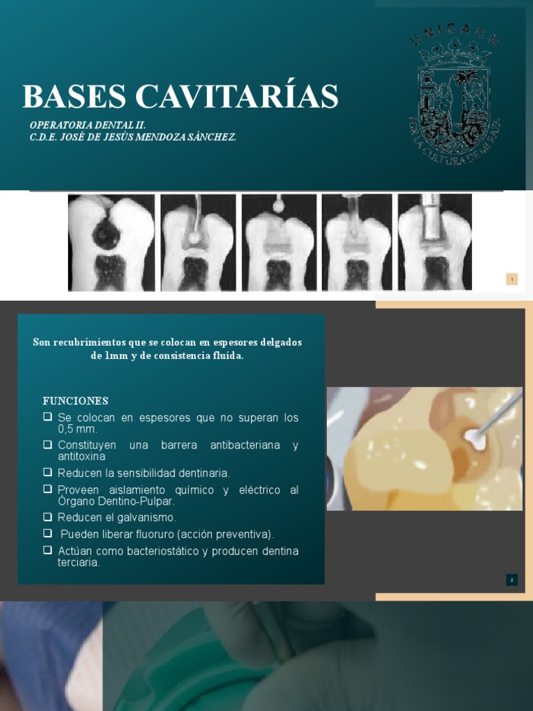 BASES CAVITARIAS Este Si PDF Cemento Zinc