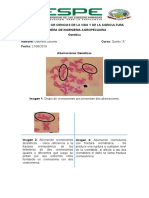 Aberraciones Cromosomicas