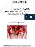 Mononucleosis: Síntomas, causas y tratamiento de la enfermedad del beso