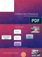 Hipertensión pulmonar en neonatos