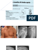 4. MIEMBRO SUPERIOR-FX DE HUMERO PROXIMAL,OLECRANON Y RADIO DISTAL 1