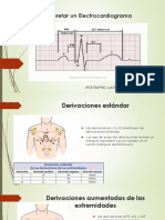 Como Interpretar Un Electrocardiograma