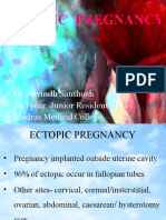 Ectopic Pregnancy Focus