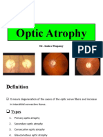Optic Nerve Diseases II- Audio(1)