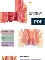 Enfermedad Hemorroidal