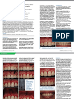 Periodontal Plastic Surgery For The Management of Altered Passive Eruption