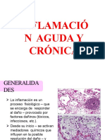 Inflamacion Aguda Cronica