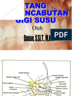 12 Tang Cabut Gigi Susu-1