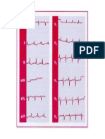 Fig2 - Cord Pulmonar Cronic