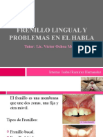 Frenillo Lingual y Problemas en El Habla
