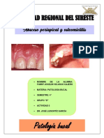 Absceso Periapical y Osteomielitis