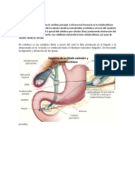 Coledocolitiasis