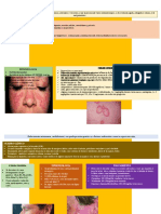 Lupus Sistemico y Discoide