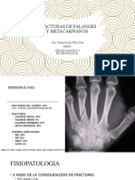 Fractura de Falanges y Metacarpianos Dipd