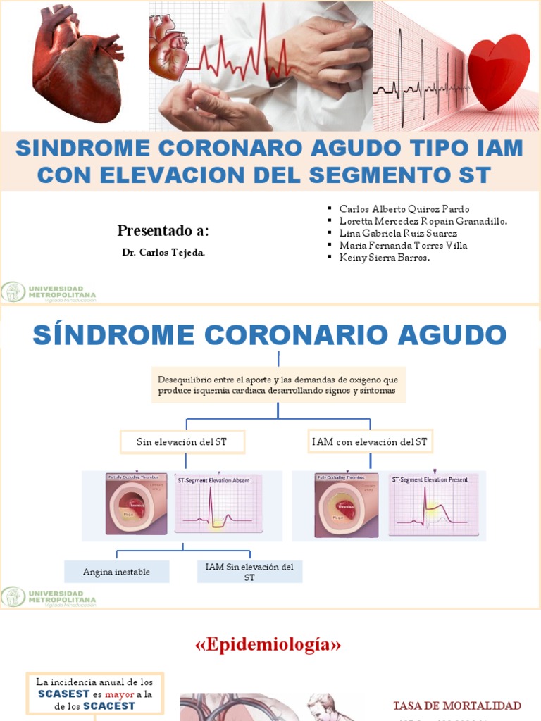 Iam Con Elevacion ST | PDF | Insuficiencia cardíaca | Infarto de miocardio