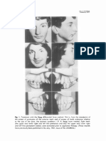 Differential FOrce Method of Orthodontic Treatment (1977) (Dragged)