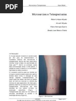 Cap1 Microvarizes e Telangectasias