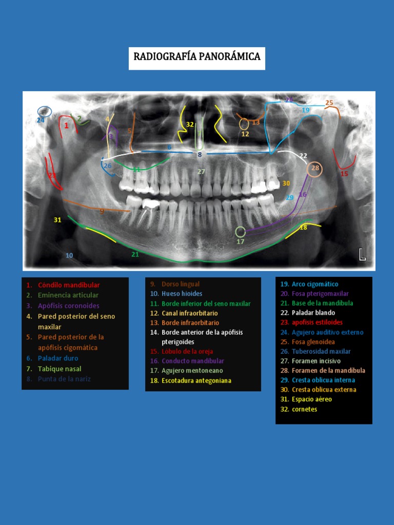 anatomia-de-la-radiografia-panoramica-pdf-sistema