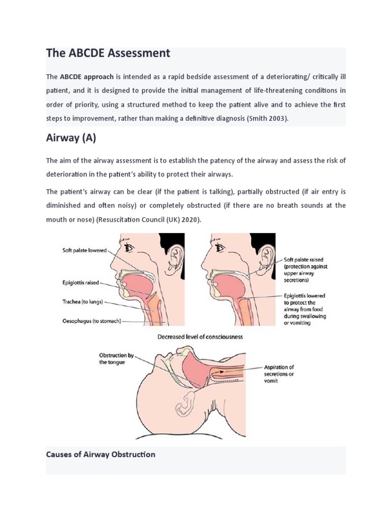 The ABCDE Assessment: Airway (A) | PDF | Heart | Breathing