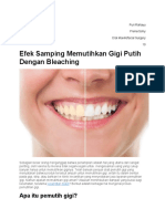Efek Samping Memutihkan Gigi Putih Dengan Bleaching