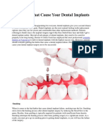 Bad Habits That Cause Your Dental Implants To Fail