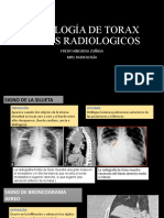 Radiologia de Torax