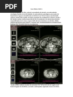 Protocolo Mini R-CHOP de Quimioterapia | PDF | Ciencia y matemáticas