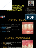 clasificacion Enfermedades Periodontales