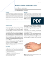 Síndrome de Martillo Hipotenar: Reporte de Un Caso: Hypothenar Hammer Syndrome: Case Report