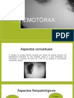 Hemotórax paresentação
