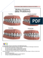 Causes of Malocclusion Treatmemt of Malocclusion